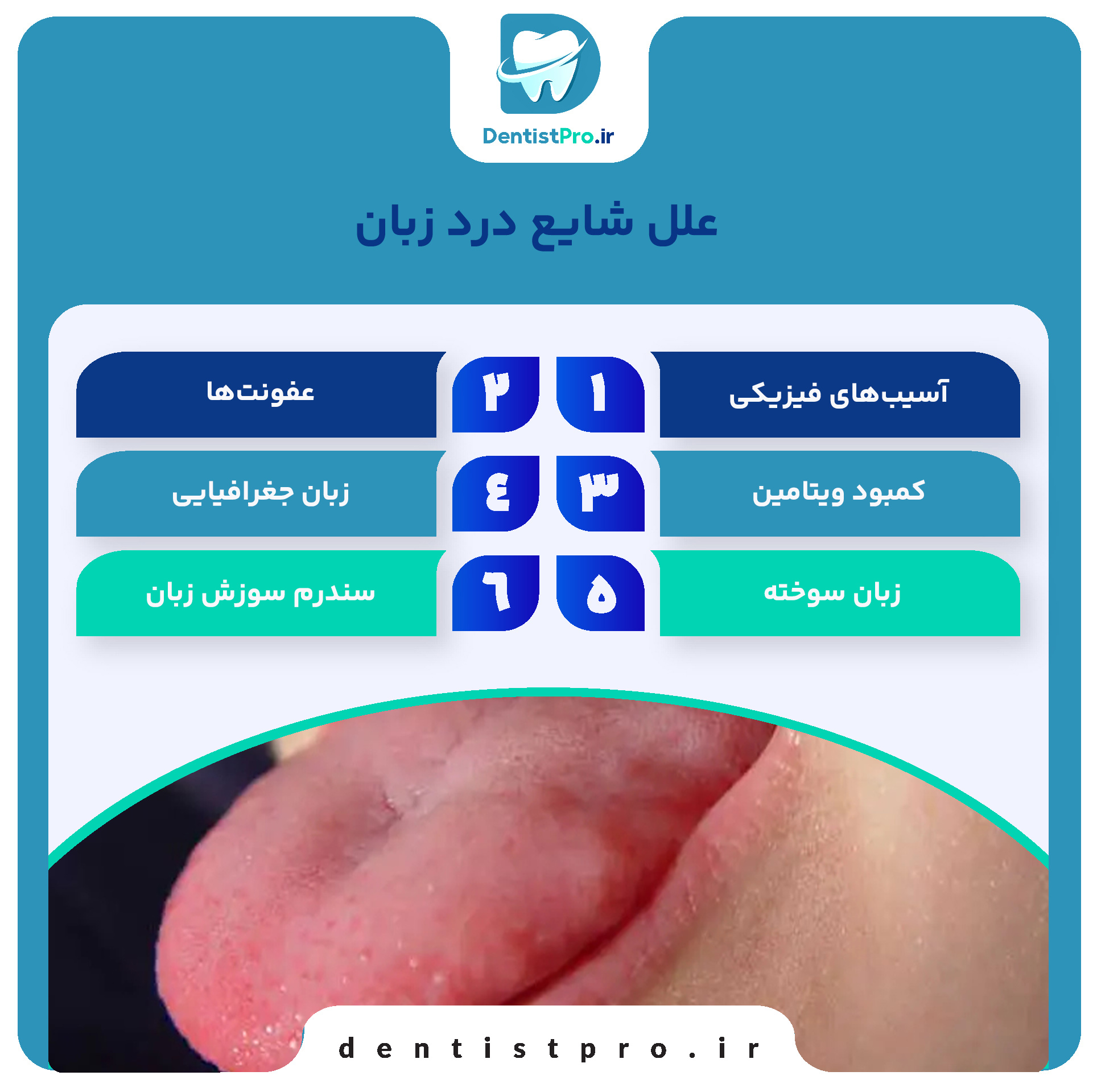 درد زبان: علل، علائم، تشخیص و راههای درمان 27 درد زبان: علل، علائم، تشخیص و راههای درمان