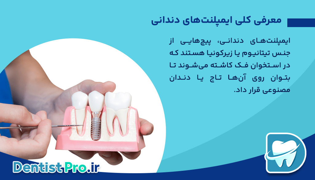 تفاوت ایمپلنت خارجی و ایرانی؛ بررسی کامل کیفیت، قیمت و ماندگاری 26 تفاوت ایمپلنت خارجی و ایرانی؛ بررسی کامل کیفیت، قیمت و ماندگاری