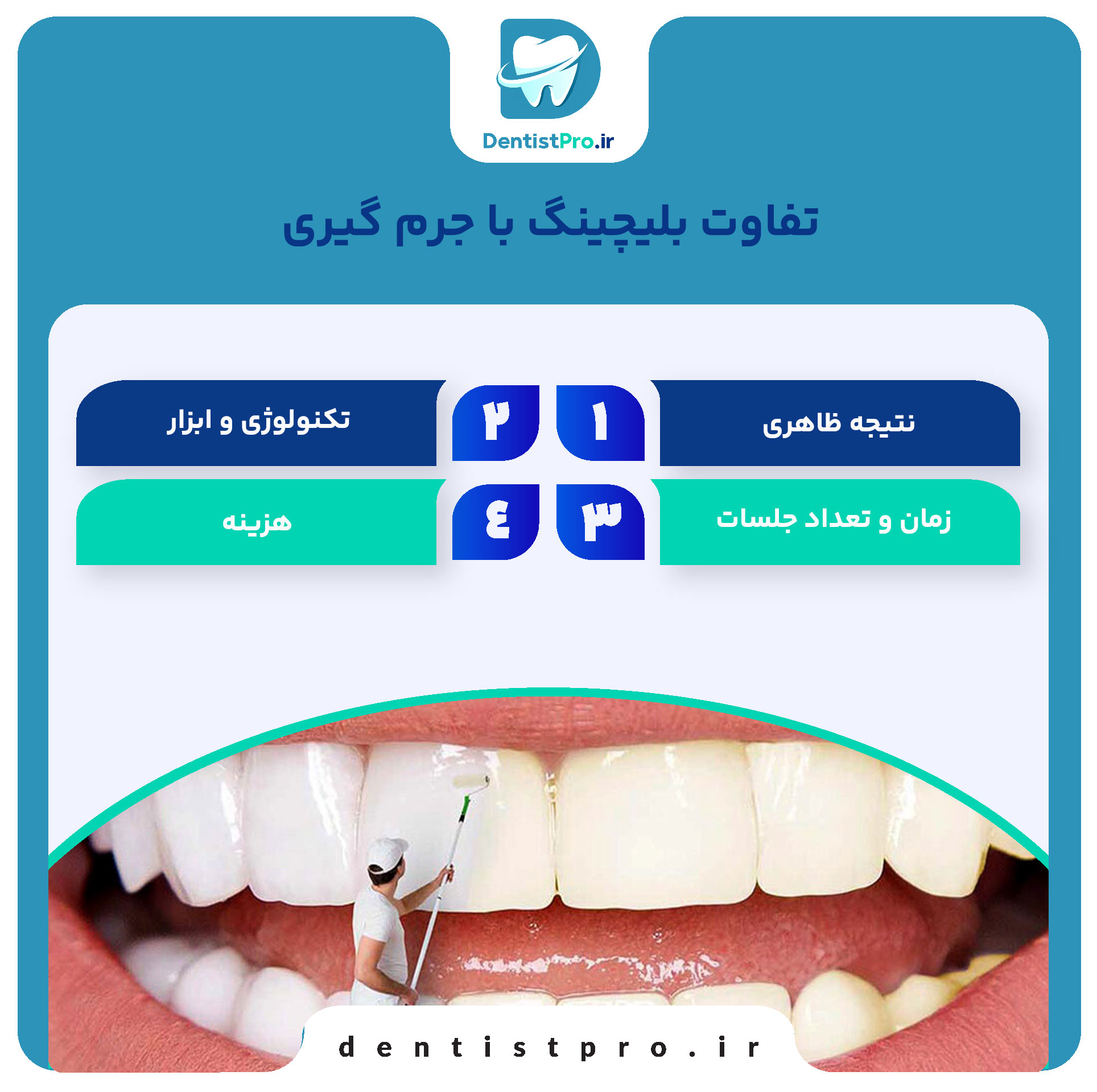 تفاوت بلیچینگ با جرم گیری؛ بررسی کامل روشهای سفید کردن دندان 28 تفاوت بلیچینگ با جرم گیری؛ بررسی کامل روشهای سفید کردن دندان