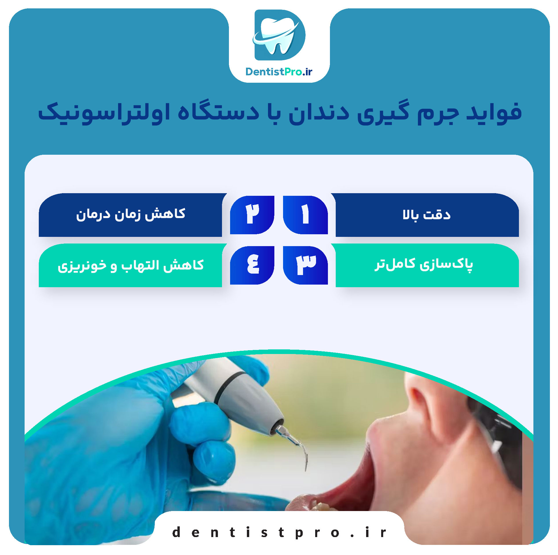 جرم گیری عمیق دندان با دستگاه اولتراسونیک: راهنمای جامع