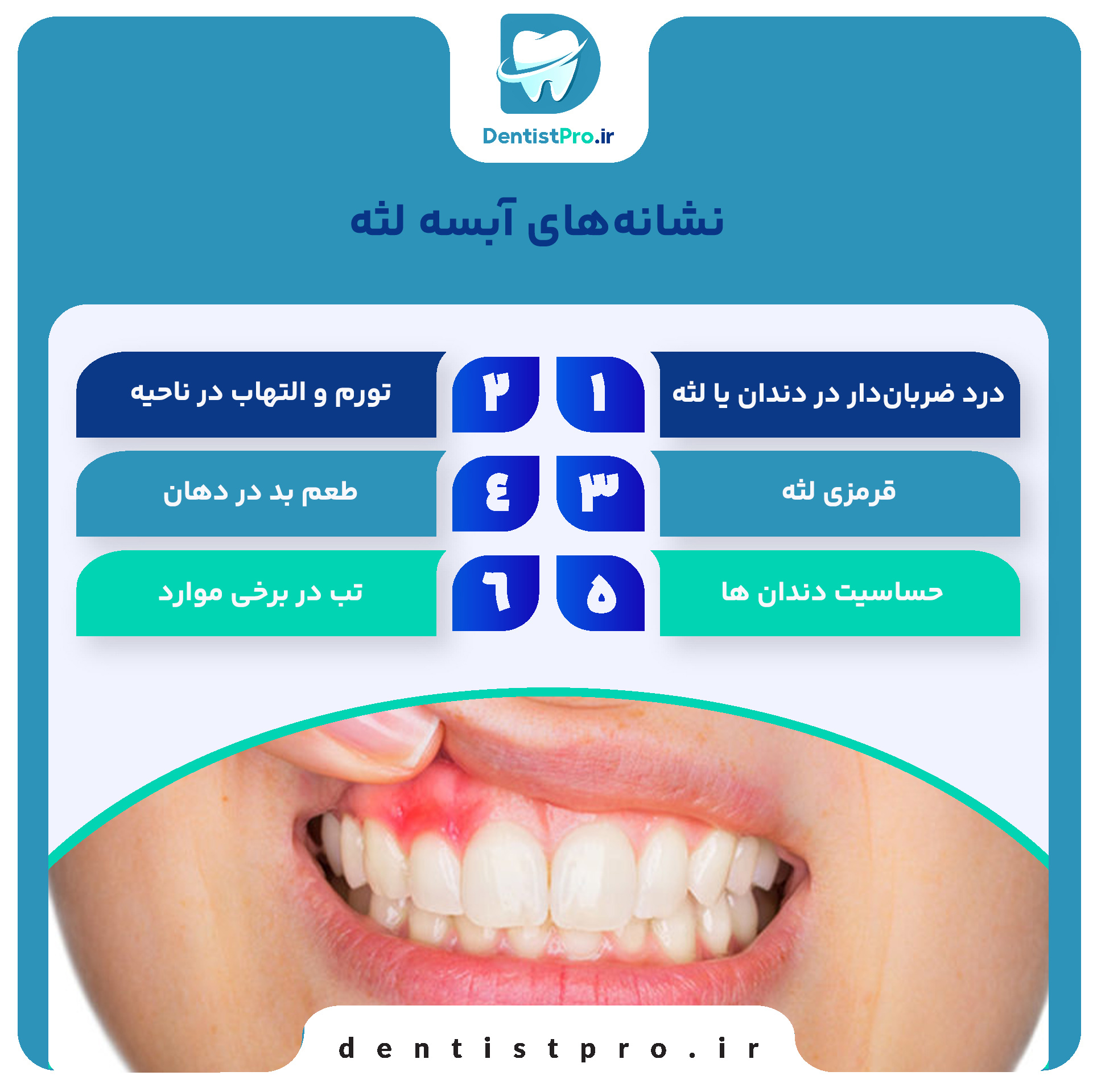 درمان آبسه لثه بدون آنتی بیوتیک