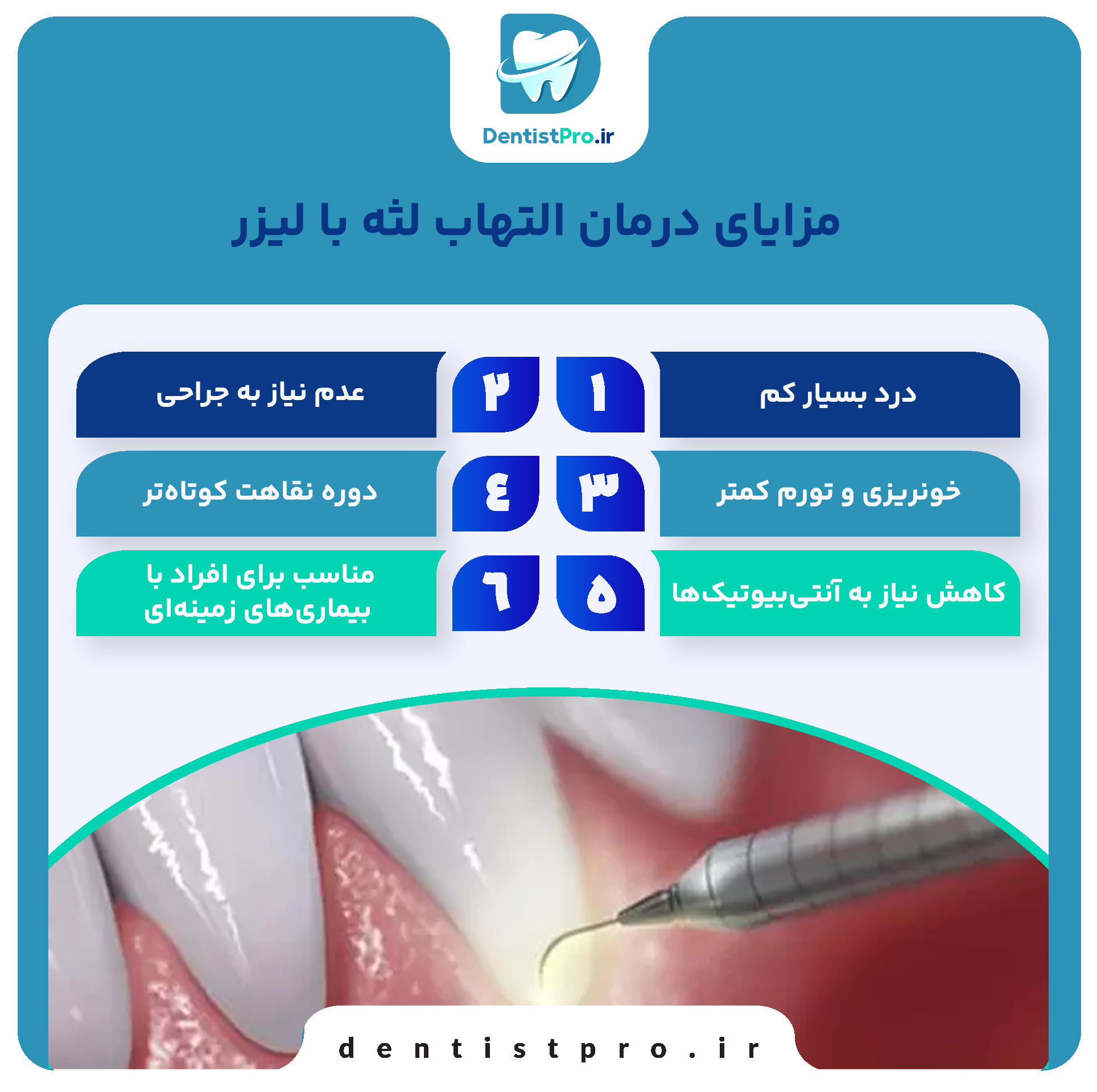 درمان التهاب لثه با لیزر: راهکاری نوین، مؤثر و بدون درد