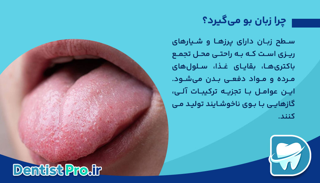 درمان خانگی برای بوی بد زبان