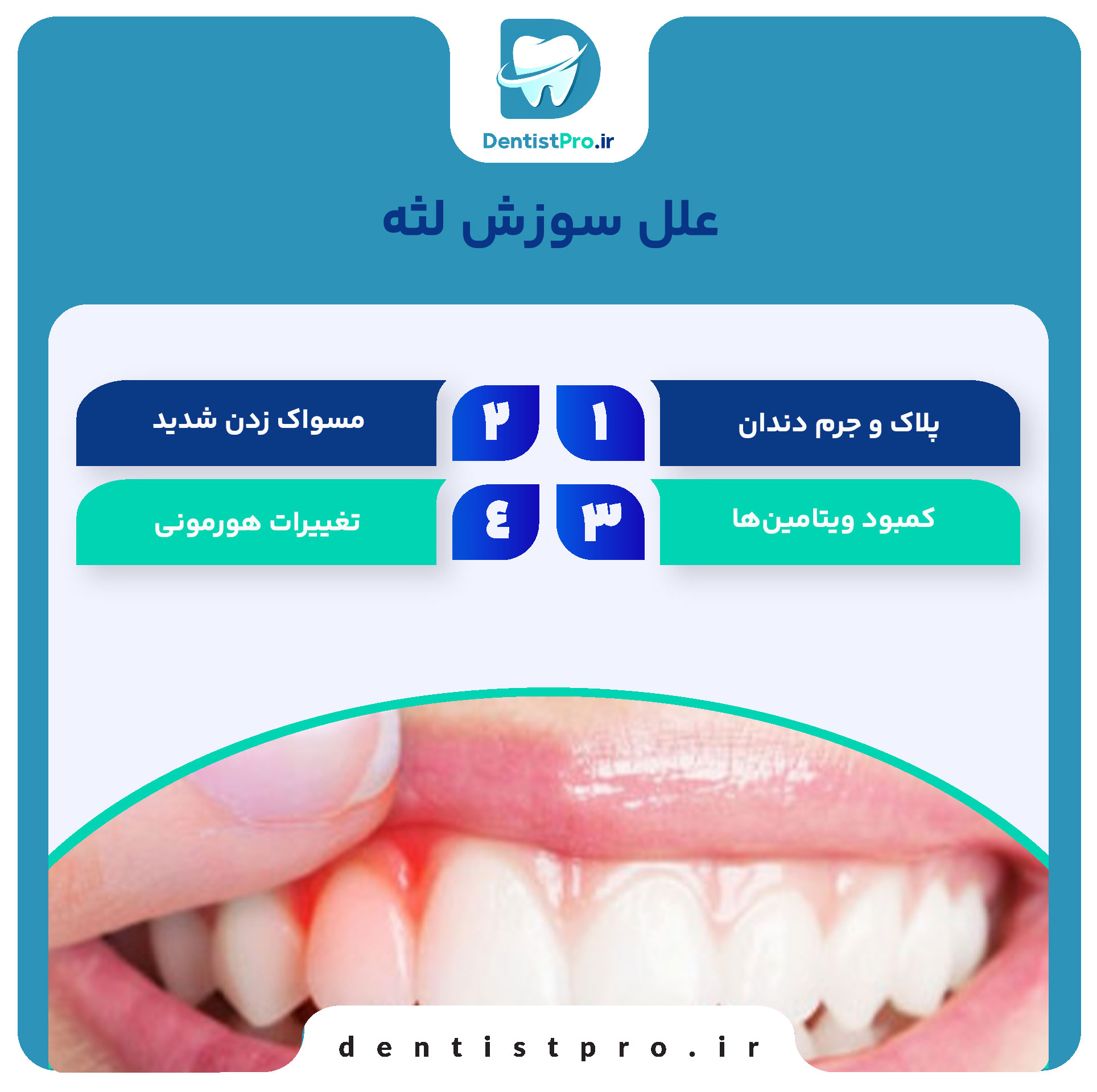 درمان خانگی برای سوزش لثه: راهکارهای طبیعی و مؤثر