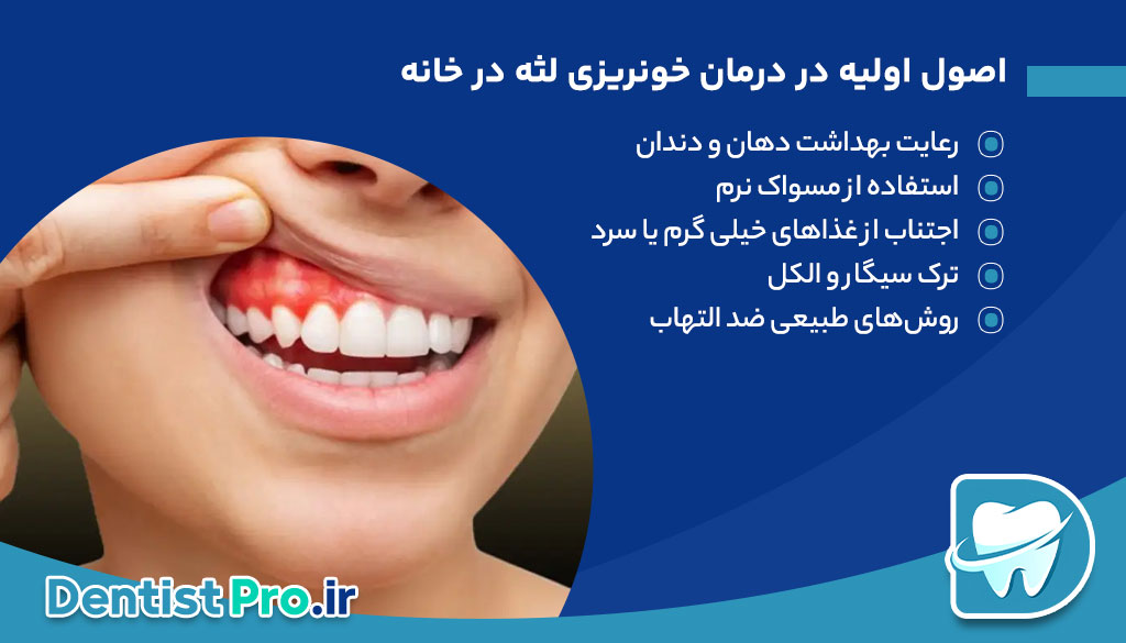 درمان خونریزی لثه در خانه+ موارد 100% حیاتی