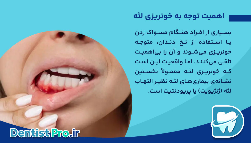 درمان خونریزی مکرر لثه ها چیست؟ 26 درمان خونریزی مکرر لثه ها چیست؟