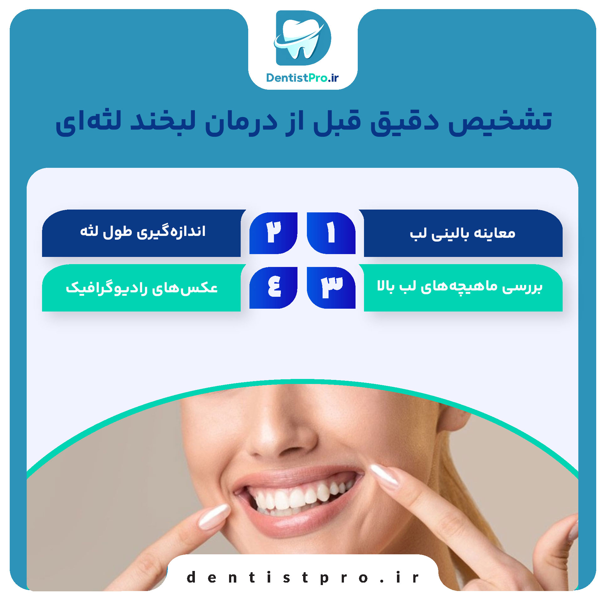 درمان لبخند لثه ای+0 تا 100 موارد مهم 28 درمان لبخند لثه ای+0 تا 100 موارد مهم