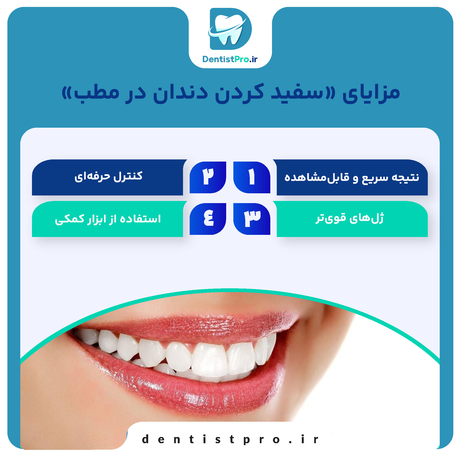 سفید کردن دندان در خانه یا مطب 26 سفید کردن دندان در خانه یا مطب