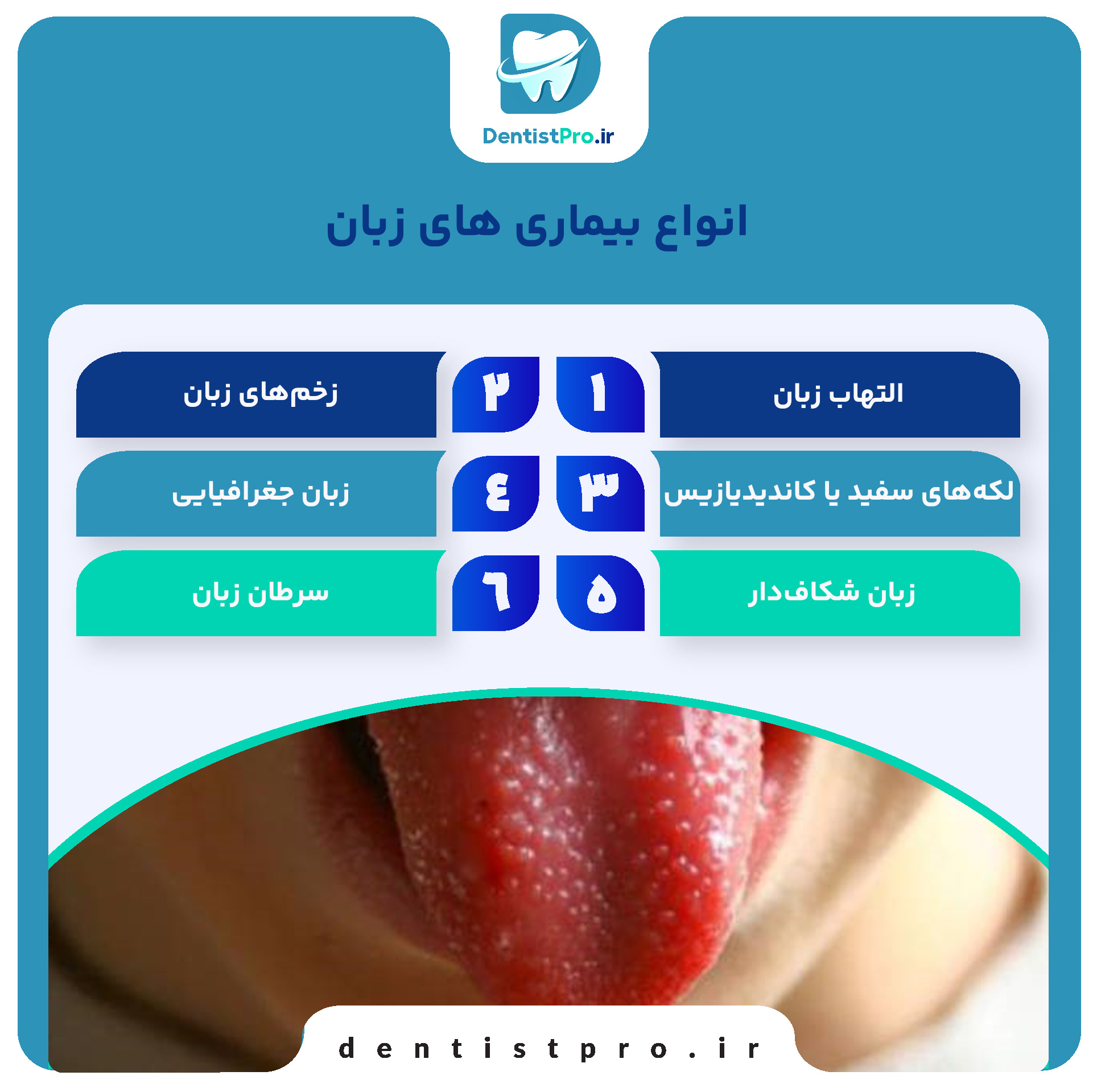 صفر تا صد بیماری های زبان+ موارد بسیار مهم در مورد زبان 27 صفر تا صد بیماری های زبان+ موارد بسیار مهم در مورد زبان