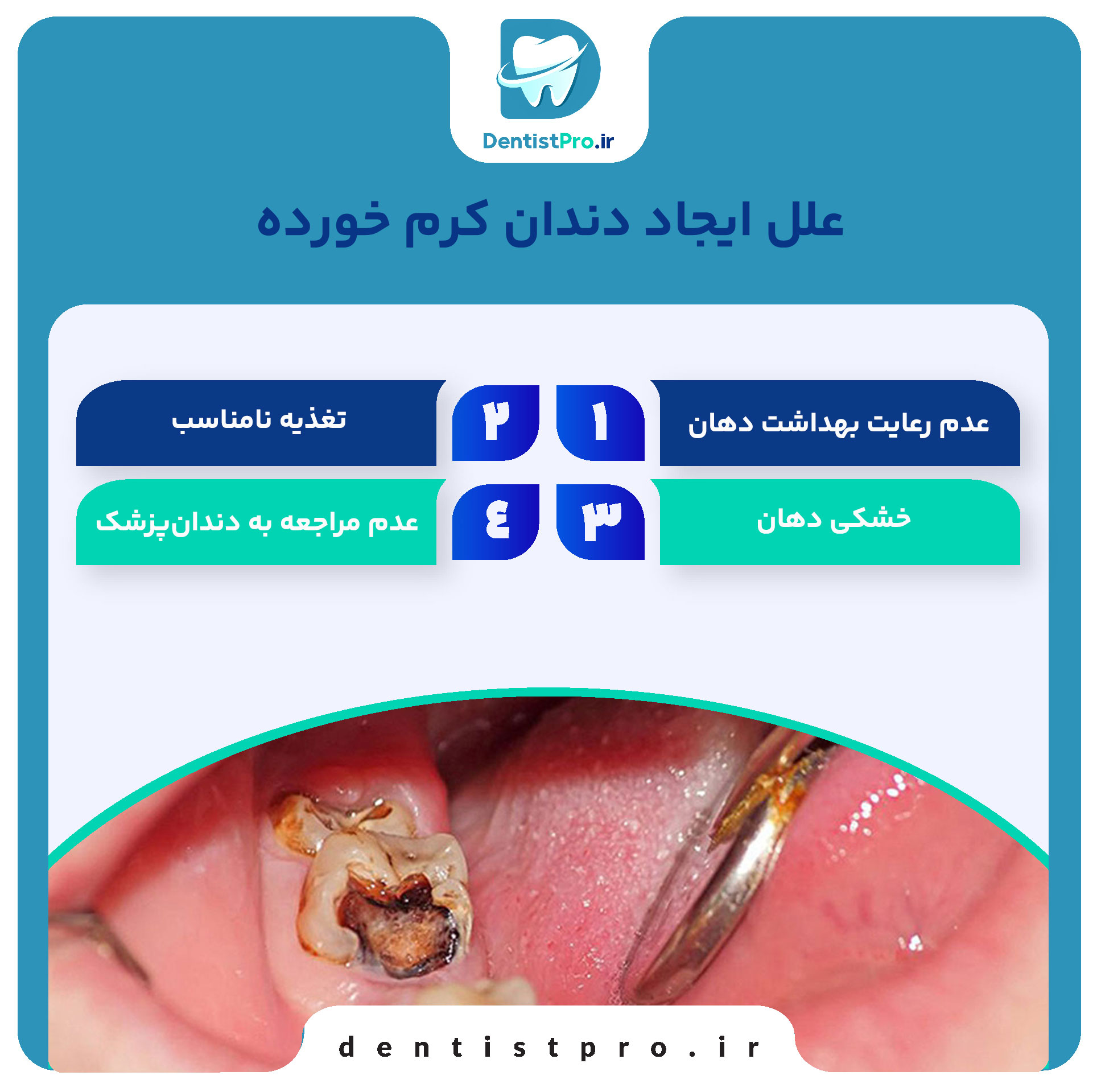 علائم دندان کرم خورده چیست؟