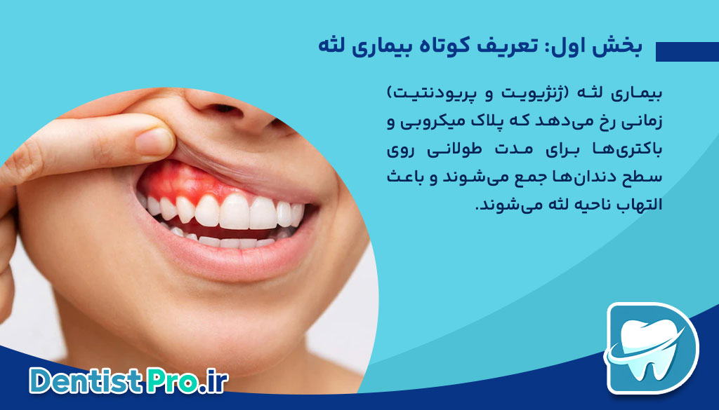 علائم هشداردهنده بیماری لثه+10 علامت هشداردهنده