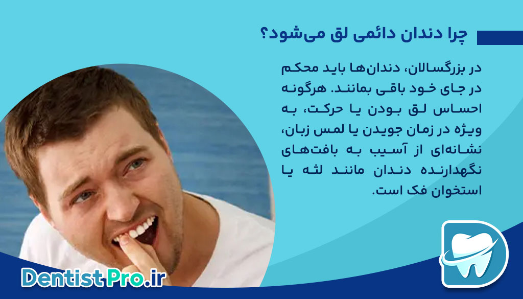 علت لق شدن دندان دائمی در بزرگسالان+0 تا 100 مطالب مهم