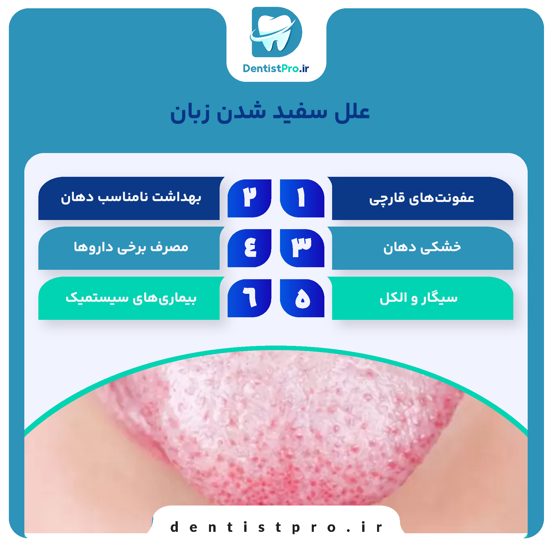 علل سفید شدن زبان چیست؟ 27 علل سفید شدن زبان چیست؟