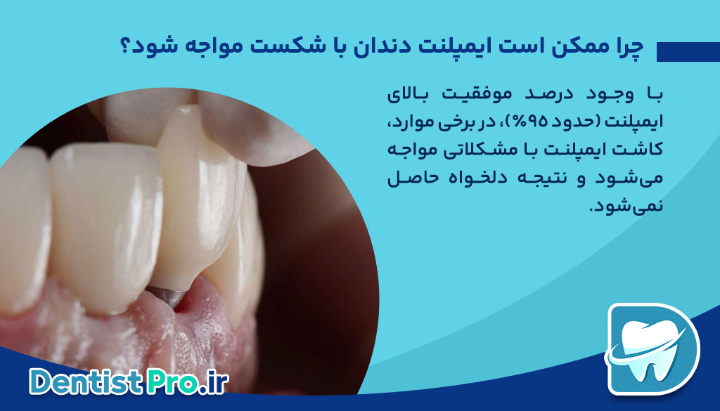 عوارض احتمالی ایمپلنت ناموفق؛ دلایل، علائم و راه‌های پیشگیری
