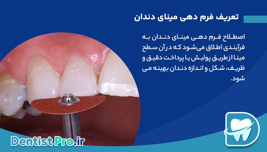 فرم دهی مینای دندان چیست؟ 26 فرم دهی مینای دندان چیست؟