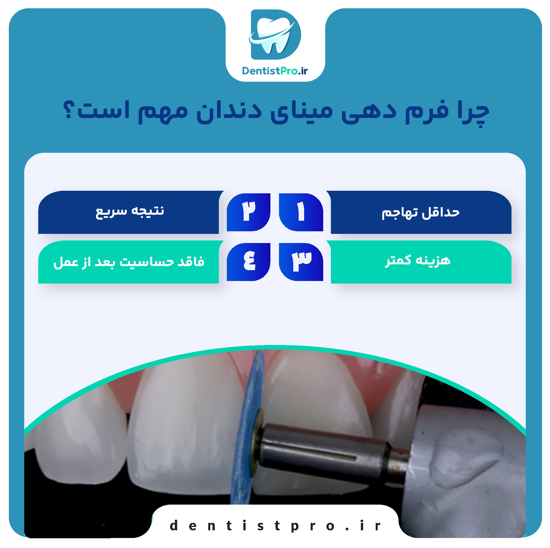 فرم دهی مینای دندان چیست؟ 27 فرم دهی مینای دندان چیست؟
