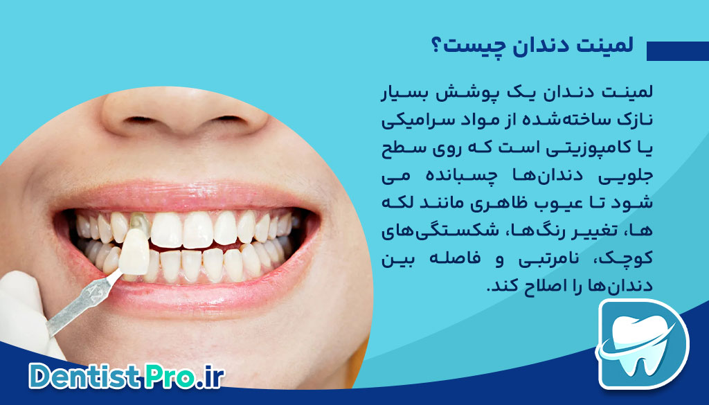 لمینت دندان بدون تراش مینای دندان: راهکاری نوین برای زیبایی لبخند