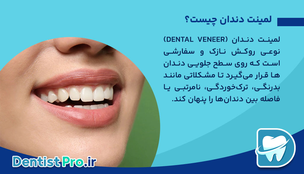 لمینت دندان برای بازیگران: راز لبخندهای درخشان در سینما و تلویزیون