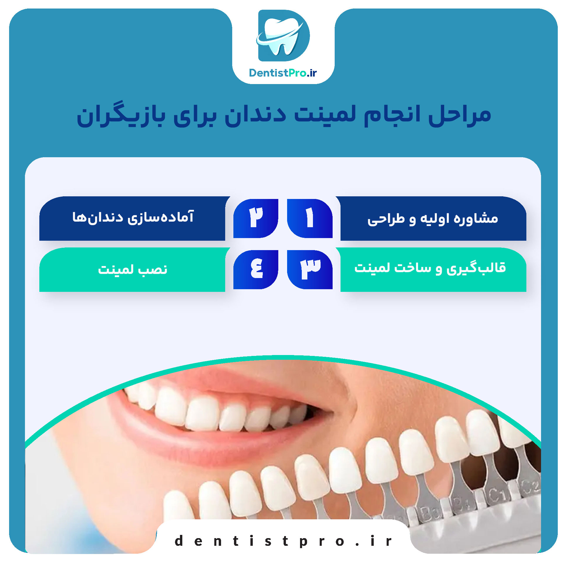 لمینت دندان برای بازیگران: راز لبخندهای درخشان در سینما و تلویزیون