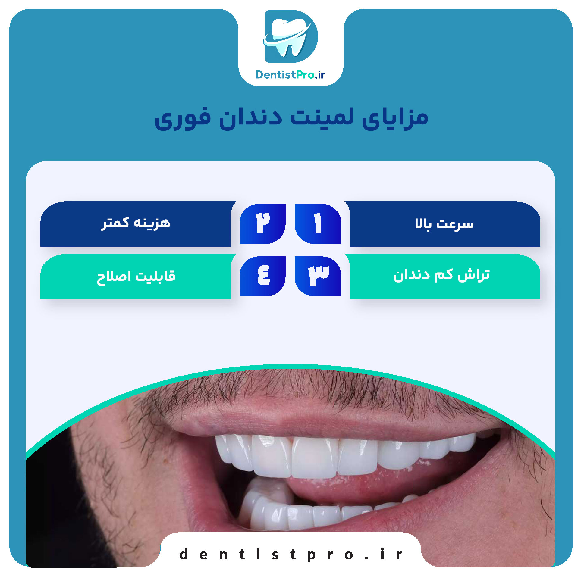 لمینت دندان فوری؛ راهی سریع برای داشتن لبخندی جذاب 27 لمینت دندان فوری؛ راهی سریع برای داشتن لبخندی جذاب