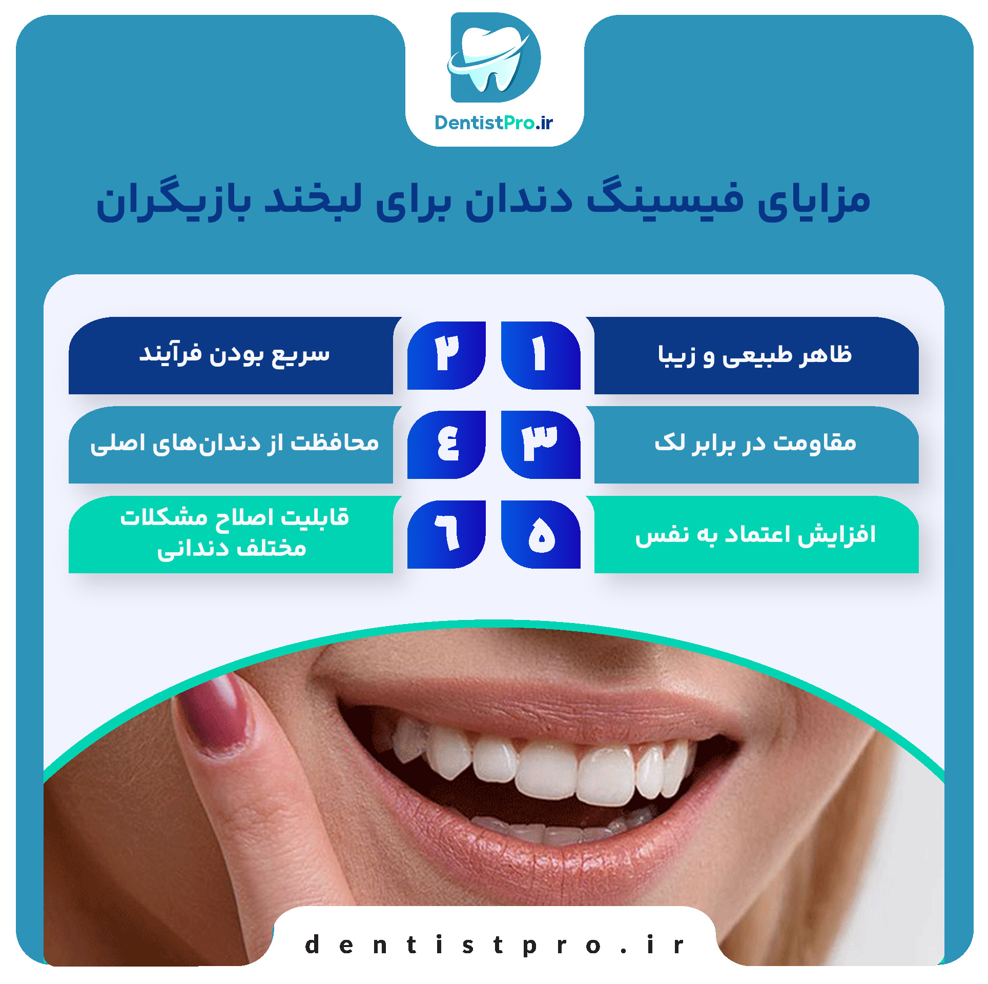 فیسینگ دندان برای لبخند بازیگران؛ راز زیبایی بینقص و اعتماد به نفس 28 فیسینگ دندان برای لبخند بازیگران؛ راز زیبایی بینقص و اعتماد به نفس