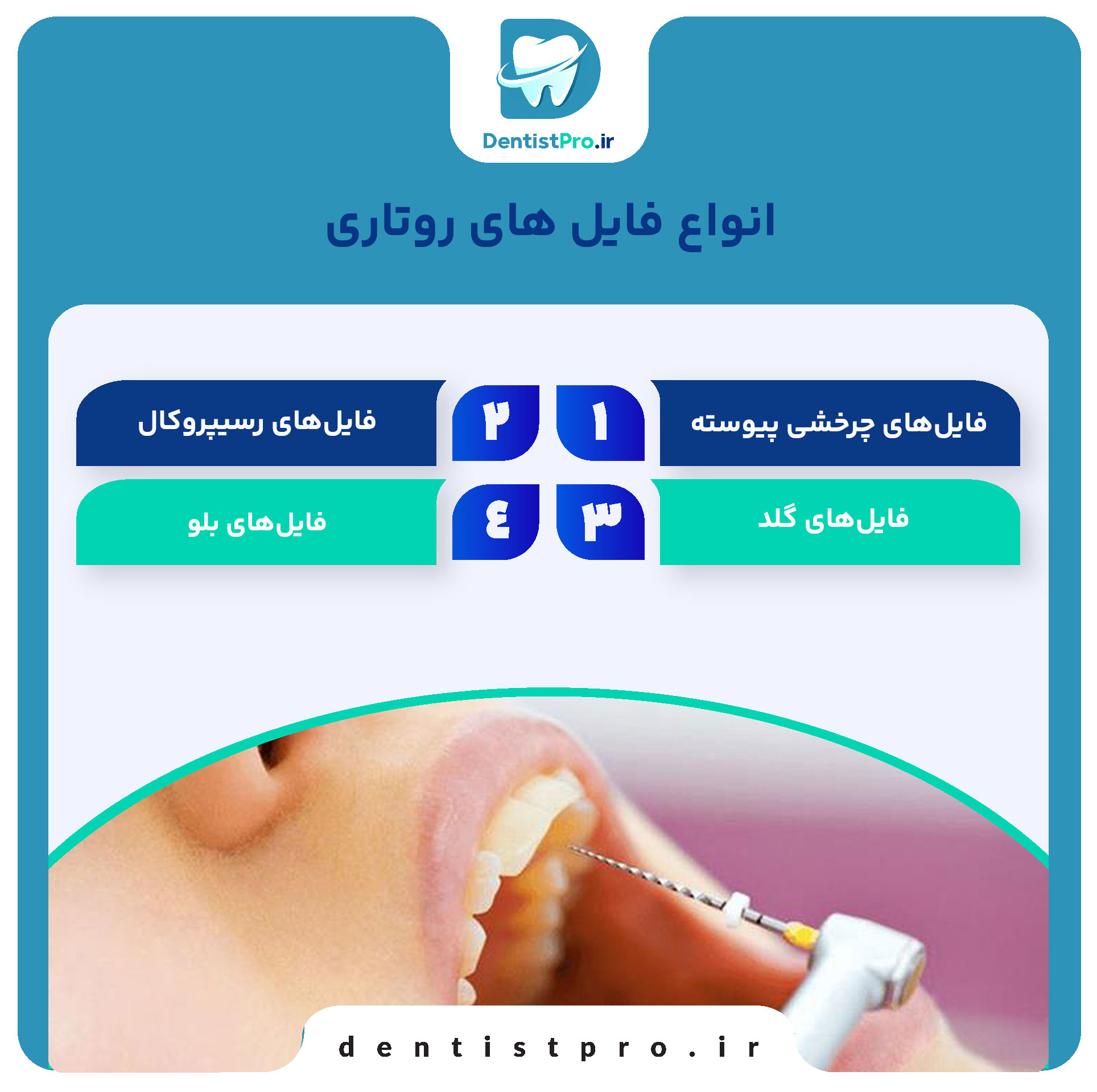 معرفی انواع فایل های روتاری در دندانپزشکی 27 معرفی انواع فایل های روتاری در دندانپزشکی