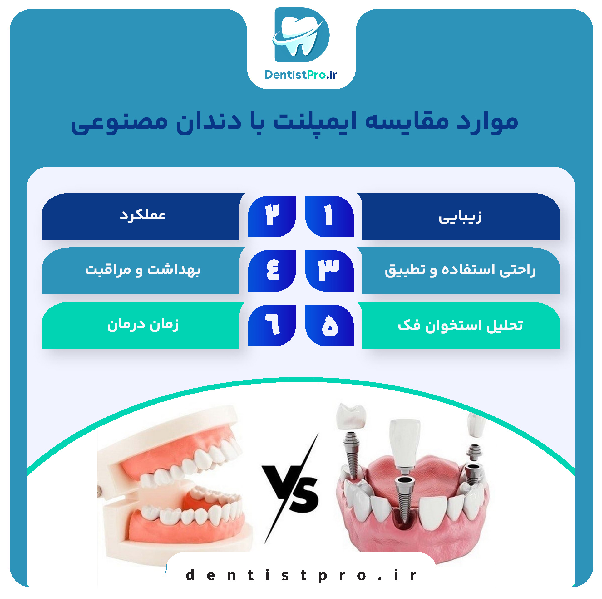 مقایسه ایمپلنت با دندان مصنوعی؛ راهنمای کامل انتخاب جایگزین دندان از دست‌رفته