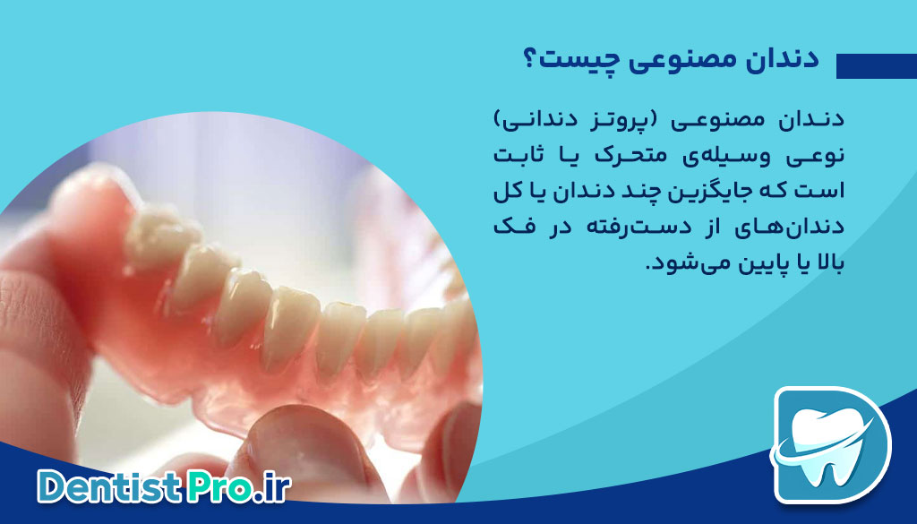 مقایسه ایمپلنت با دندان مصنوعی؛ راهنمای کامل انتخاب جایگزین دندان از دست‌رفته