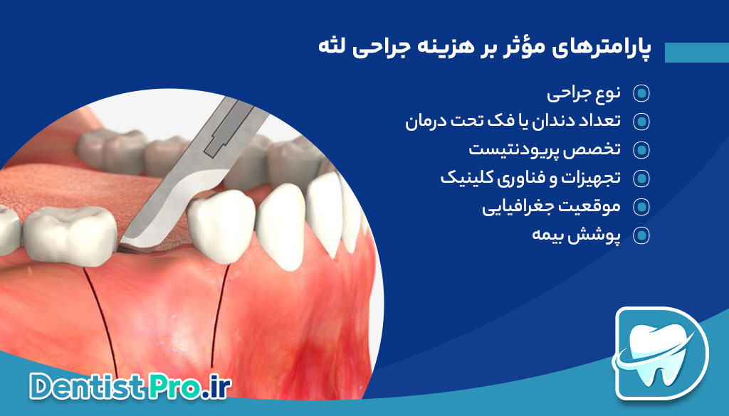 هزینه جراحی لثه؛ بررسی کامل تعرفهها و پارامترهای مؤثر 27 هزینه جراحی لثه؛ بررسی کامل تعرفهها و پارامترهای مؤثر