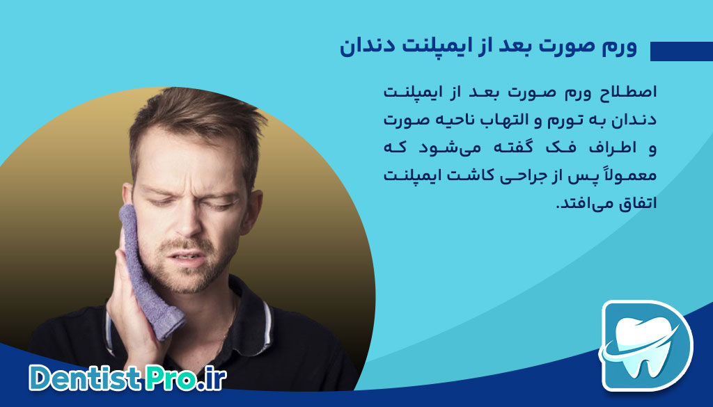 ورم صورت بعد از ایمپلنت دندان؛ علل، روش‌های کنترل و مراقبت‌های لازم