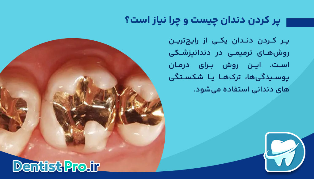 پر کردن دندان بدون صدای دریل: انقلابی در دندانپزشکی مدرن 26 پر کردن دندان بدون صدای دریل: انقلابی در دندانپزشکی مدرن