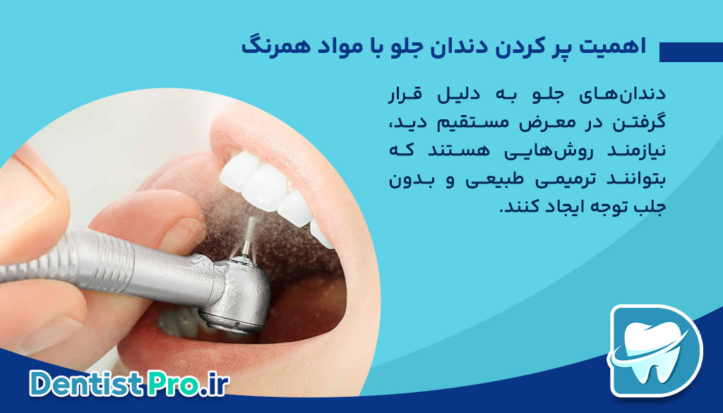 پر کردن دندان جلو با مواد همرنگ: راهکاری زیبا و موثر برای ترمیم دندانهای جلو 26 پر کردن دندان جلو با مواد همرنگ: راهکاری زیبا و موثر برای ترمیم دندانهای جلو