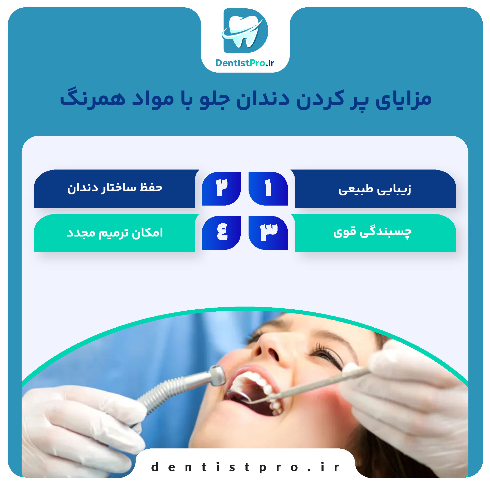 پر کردن دندان جلو با مواد همرنگ: راهکاری زیبا و موثر برای ترمیم دندانهای جلو 27 پر کردن دندان جلو با مواد همرنگ: راهکاری زیبا و موثر برای ترمیم دندانهای جلو