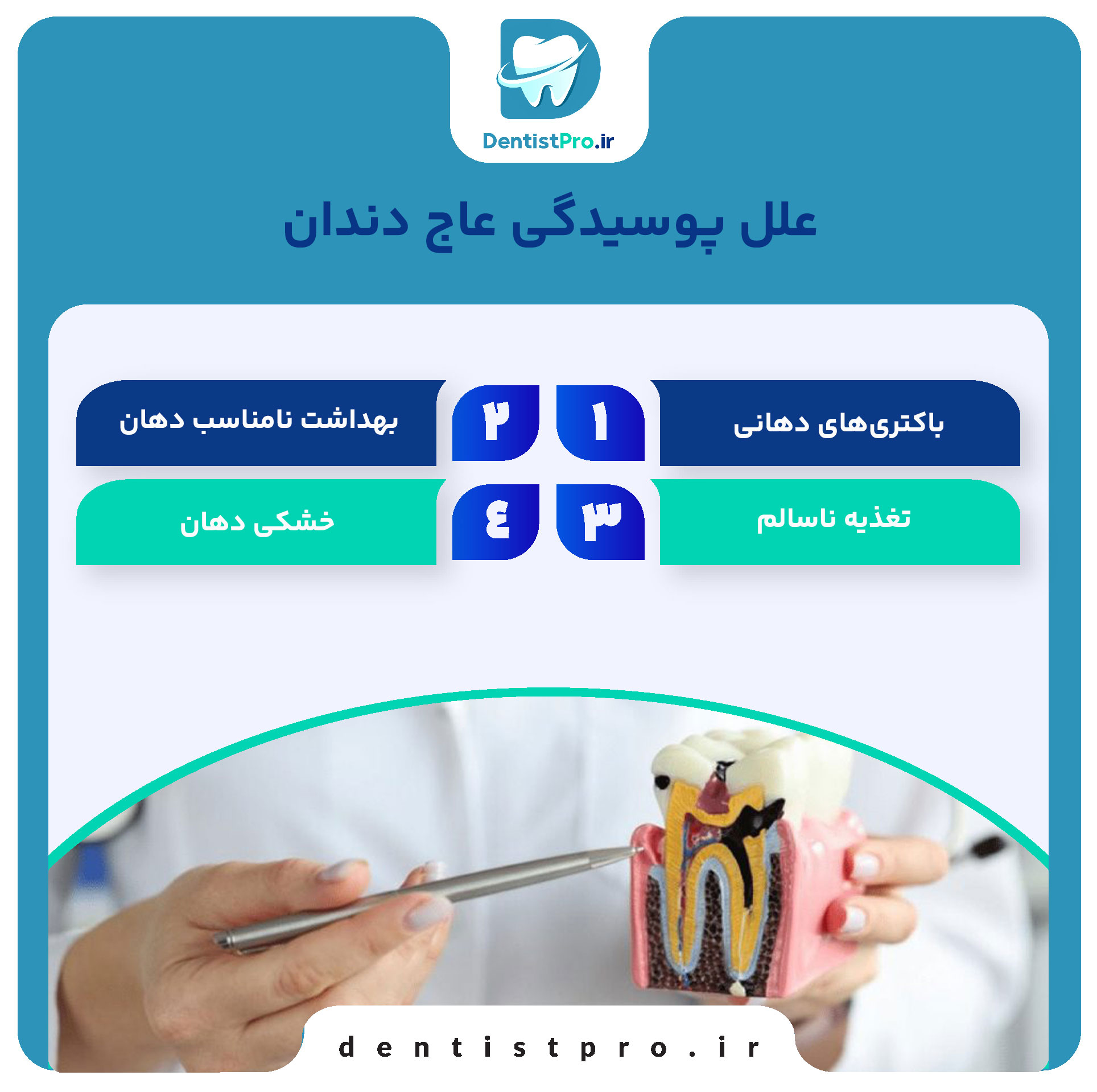 پوسیدگی عاج دندان؛ بررسی علل، علائم و روش‌های درمانی