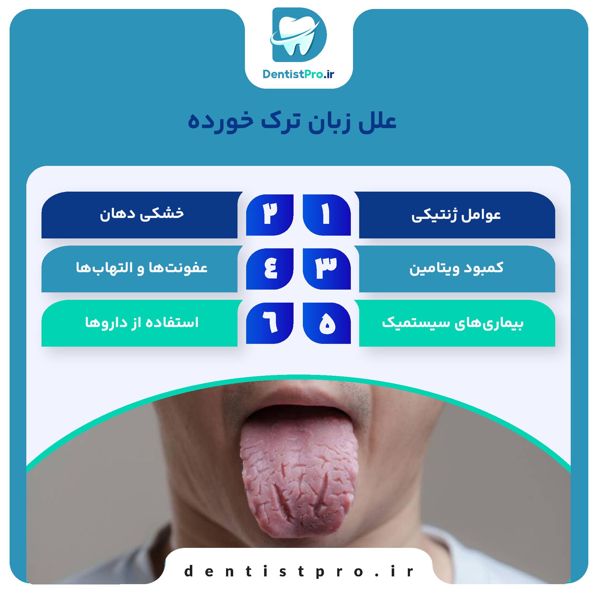 چرا زبان ترک خورده می شود؟