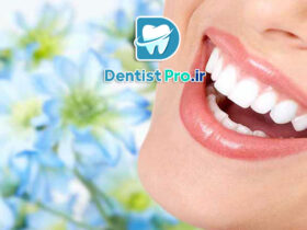 لبخند زیبا با دندان های مرتب+10 نکته کاربردی