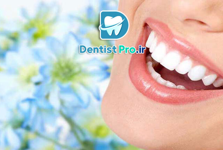 لبخند زیبا با دندان های مرتب+10 نکته کاربردی 27 لبخند زیبا با دندان های مرتب+10 نکته کاربردی