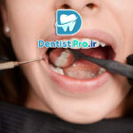 اگر صورت‌تان ناگهان ورم کرد، مراقب باشید! تورم صورت به خاطر عفونت دندان را جدی بگیرید