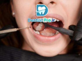 اگر صورتتان ناگهان ورم کرد، مراقب باشید! تورم صورت به خاطر عفونت دندان را جدی بگیرید 35 اگر صورتتان ناگهان ورم کرد، مراقب باشید! تورم صورت به خاطر عفونت دندان را جدی بگیرید