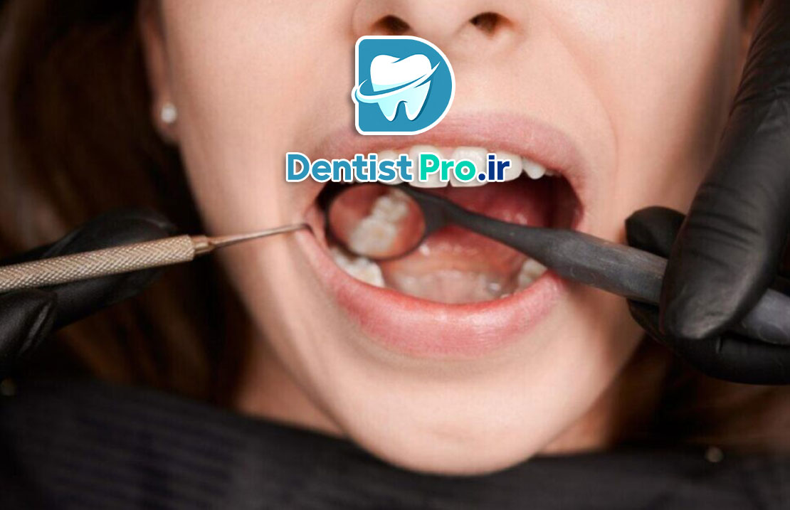 اگر صورت‌تان ناگهان ورم کرد، مراقب باشید! تورم صورت به خاطر عفونت دندان را جدی بگیرید