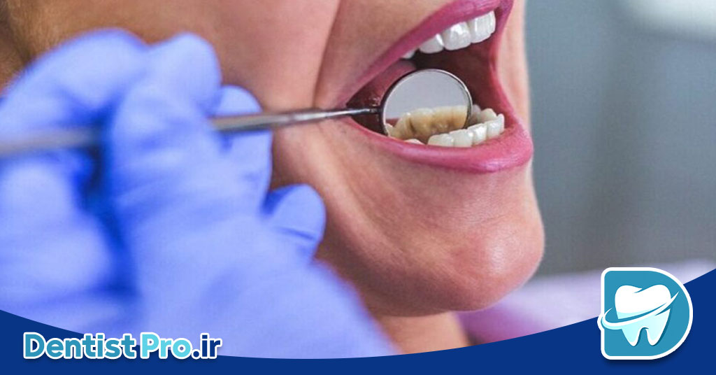 اگر صورت‌تان ناگهان ورم کرد، مراقب باشید! تورم صورت به خاطر عفونت دندان را جدی بگیرید