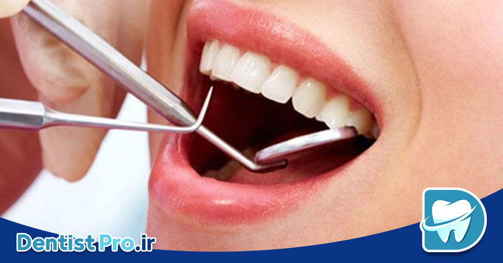 کشیدن دندان بدون درد در کلینیک مدرن: تجربه‌ای نوین در درمان‌های دندان‌پزشکی