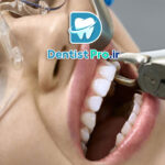 کشیدن دندان بدون درد در کلینیک مدرن: تجربه‌ای نوین در درمان‌های دندان‌پزشکی