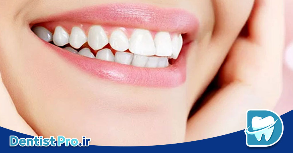 دندان های مرواریدی بدون دردسر