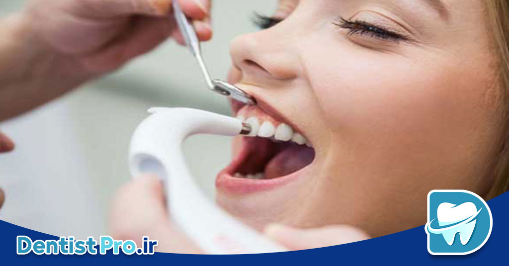 ارتودنسی سریع برای نوجوانان