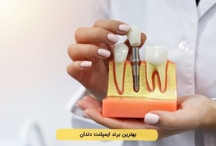 معرفی بهترین برندهای ایمپلنت دندان (1404) + رتبهبندی + مقایسه سوئیسی تا کرهای 37 معرفی بهترین برندهای ایمپلنت دندان (1404) + رتبهبندی + مقایسه سوئیسی تا کرهای