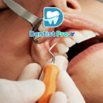 فرم دهی دندان های جلو؛ راهنمایی جامع از زبان یک متخصص دندانپزشک