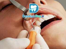 فرم دهی دندان های جلو؛ راهنمایی جامع از زبان یک متخصص دندانپزشک 68 فرم دهی دندان های جلو؛ راهنمایی جامع از زبان یک متخصص دندانپزشک
