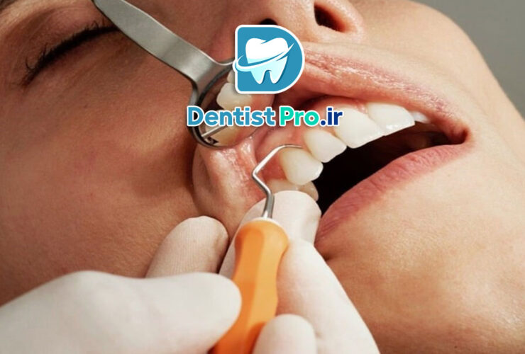 فرم دهی دندان های جلو؛ راهنمایی جامع از زبان یک متخصص دندانپزشک