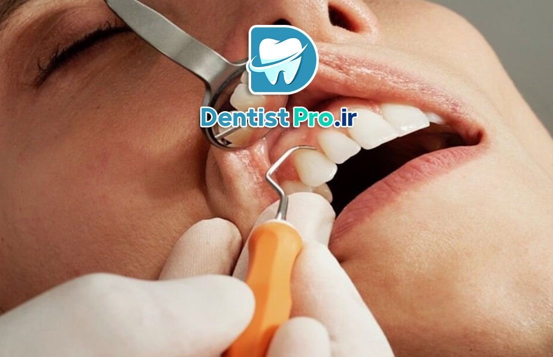 فرم دهی دندان های جلو؛ راهنمایی جامع از زبان یک متخصص دندانپزشک